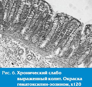 Адсорбенты для кишечника препараты