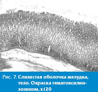 Адсорбенты для кишечника препараты