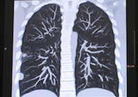 Правила конструктивного использования электронных карт теперь затрагивают и пациентов