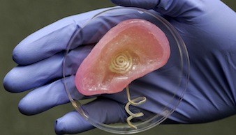 бионическое ухо