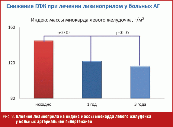 Масса миокарда левого. Гипертрофия левого желудочка индекс массы миокарда. Индекс миокарда левого желудочка. ИММЛЖ норма. Индекс массы миокарда левого.