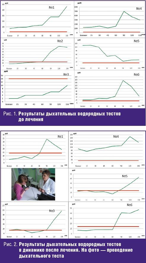 Водородный тест