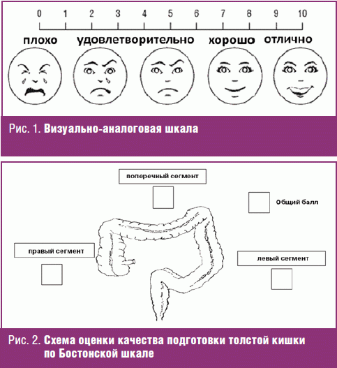 КАЧЕСТВО КОЛОНОСКОПИИ