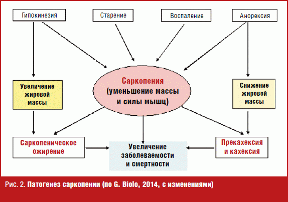 Саркопения что это такое симптомы лечение у женщин препараты схема лечения