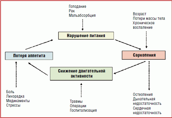 Саркопения что это такое симптомы лечение у женщин препараты схема лечения