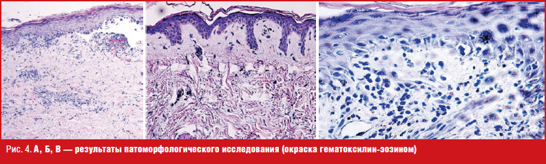 Патоморфологическая картина это