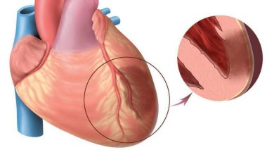 Разработан препарат для регенерации сердца после инфаркта миокарда