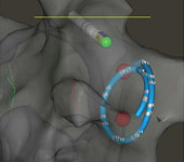 Сверхчувствительность для сердца