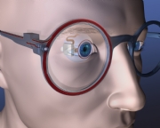 С имплантатами жизнь станет лучше